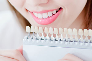 ホワイトニング