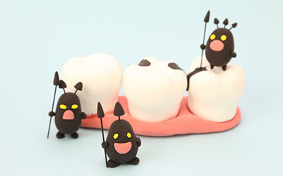 虫歯のイメージ