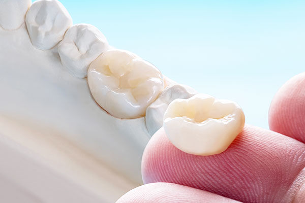 歯の詰め物やかぶせ物