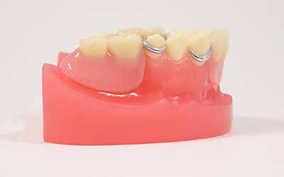 入れ歯のお手入れポイント