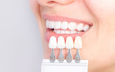 歯が自然な白さになる