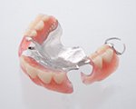 ノンクラスプデンチャー(金属床付き)