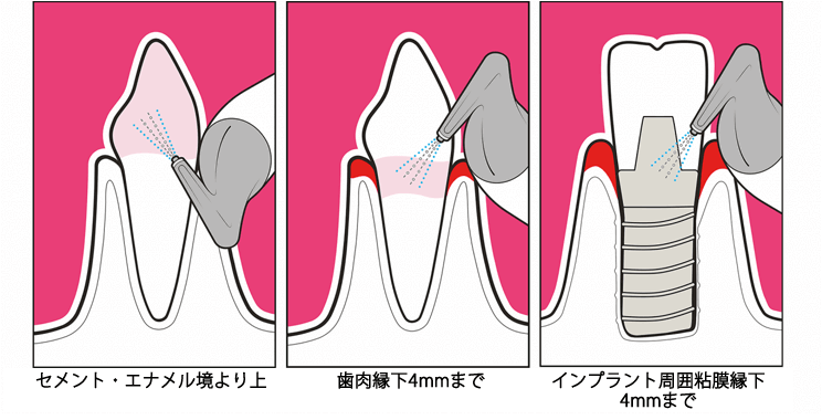 エアフロー図解