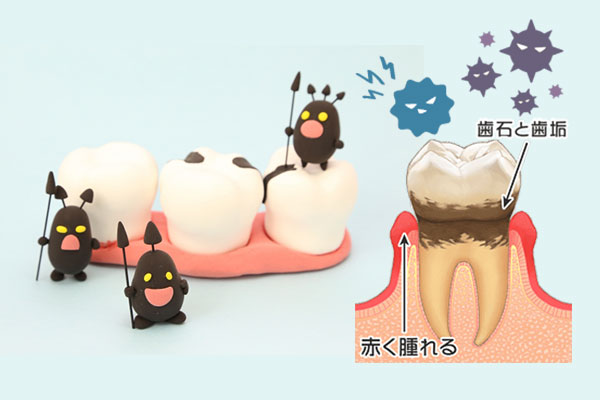 お口の中にはどんな菌がいるの?