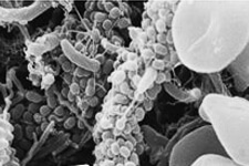 トレポネーマデンティコラ