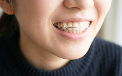 保定装置(リテーナー)を装着している様子