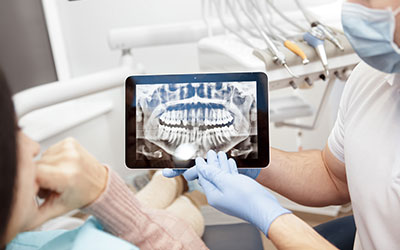 違和感や痛みが少ない