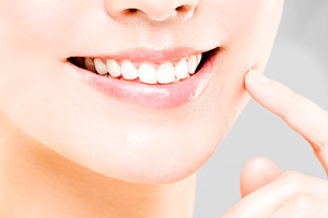 セラミック矯正