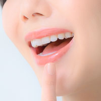 セラミック矯正