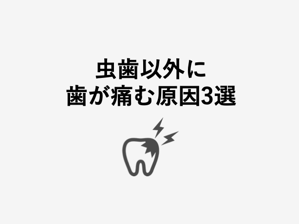 歯が痛い 虫歯以外で痛む理由3選 歯科衛生士がお口の悩みに答えます