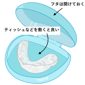 矯正用マウスピースの洗い方のコツ 歯科衛生士がお口の悩みに答えます