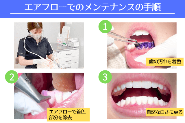 エアフローでのメンテナンス